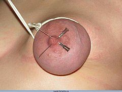 Amateur Needle Pain