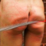 Whips Teen To Welts